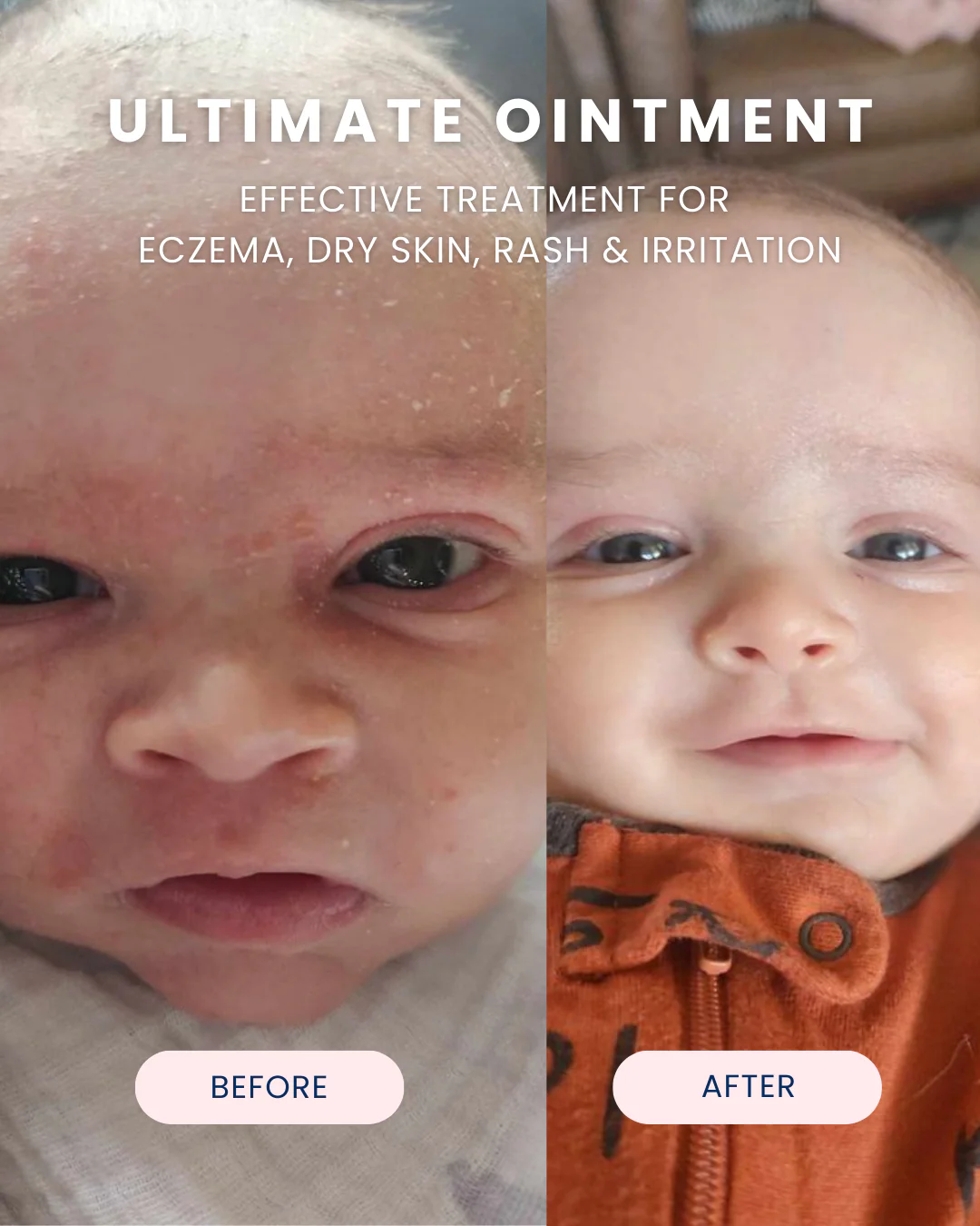 Ultimate Ointment, 3.4 oz - Image 8